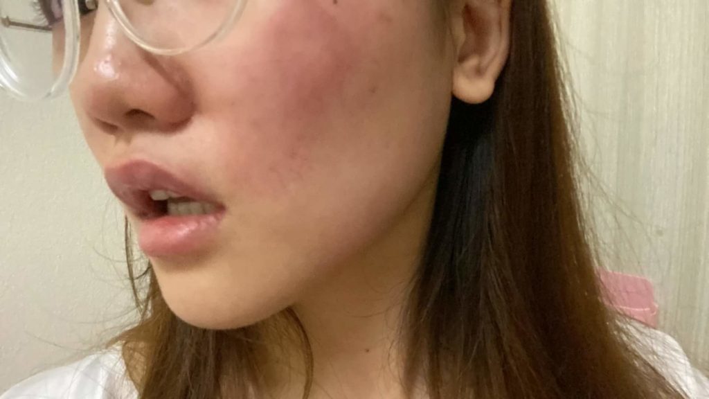 Singapore_Woman_Slapped_By_Roommate