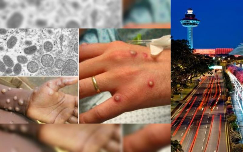 Monkeypox_case_detected_in_singapore_changi_airport