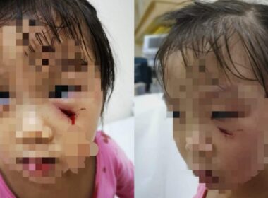 3-year-old-attacked_by_peacock_mother_files_lawsuit