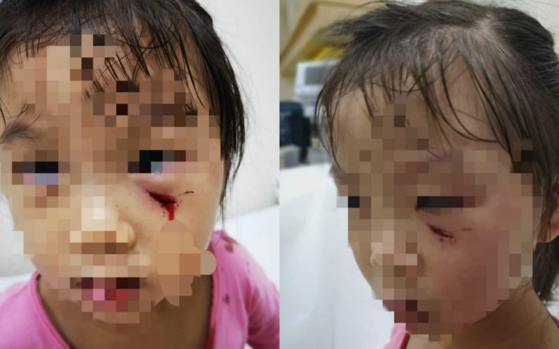 3-year-old-attacked_by_peacock_mother_files_lawsuit