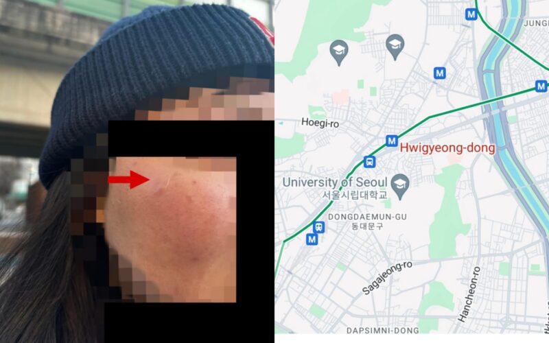 singapore_woman_attacked-in_south-korea_reddit_post